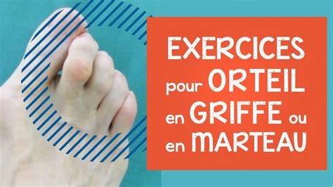 Orteil En Griffe Ou En Marteau Infos Conseils Et Exercices Efficaces D Formations Aux Pieds