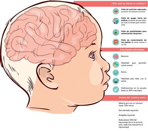 Desarrollo Del Cerebro Infantil Gamma Knife