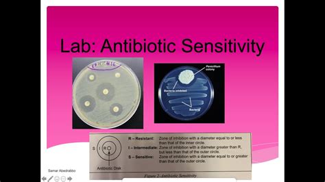 Antibiotic Sensitivity Lab Antibiotics Kirby Bauer Disk Diffusion
