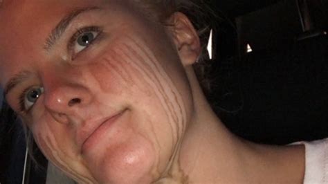 teen s post spray tan selfie goes viral fox news