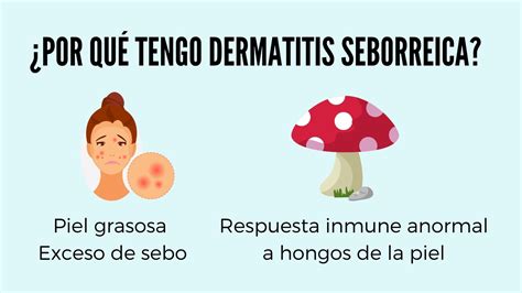 Dermatitis Seborreica ¿cómo Tratarla Guapa Skincare