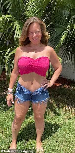 Fast Food Addict Sheds An Incredible 164lbs With Help Of A Gastric Sleeve Daily Mail Online