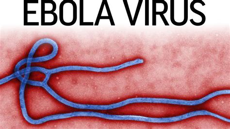 Confirmation that symptoms are caused by ebola virus infection are made using the following diagnostic methods: What are the symptoms of Ebola?