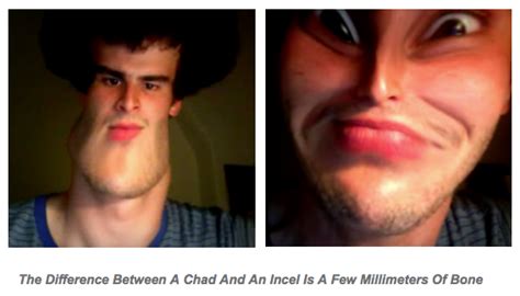 The Difference Between A Chad And An Incel Is A Few Millimeters Of Bone
