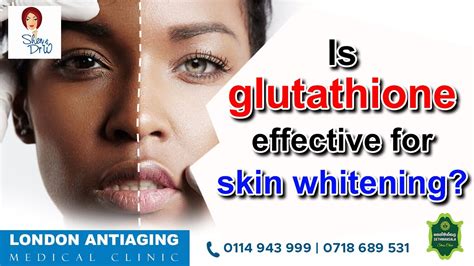 Is Glutathione Effective For Skin Whitening Youtube
