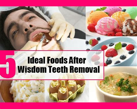 Having your wisdom teeth removed can be painful and you may experience swelling and sensitivity, which can make eating problematic. Best Foods to Eat After Tooth Extraction & Wisdom Tooth ...