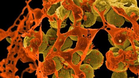 Who New Treatments Needed For Antibiotic Resistant Superbugs