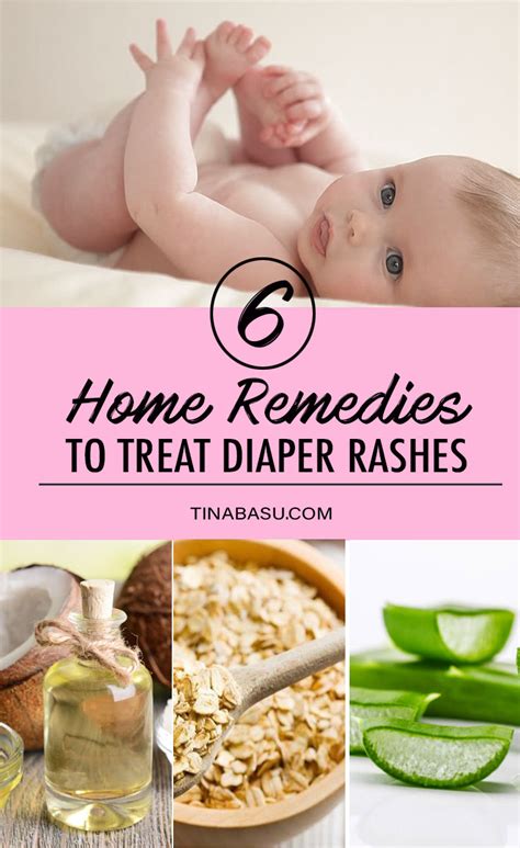 6 Effective Home Remedies To Treat Diaper Rash In Babies Babycare