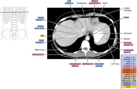 Ct Of The Abdomen Radiology Key