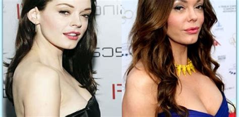 Rose Mcgowan Plastic Surgery Before And After Pictures