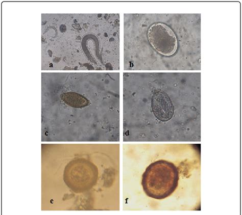 Microscopic Images Of Different Parasites Observed At 40x Download