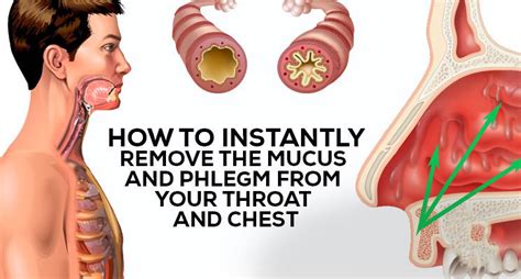 How To Get Rid Of Phlegm And Mucus In Chest And Throat Hecspot