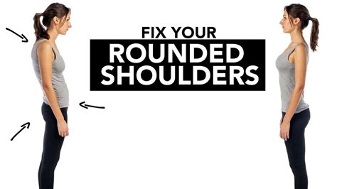 Fix Your Rounded Shoulders Better Posture In Easy Steps Youtube