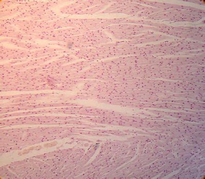 Papillary Muscle Histology Slide This Is A Histology Slide Of A