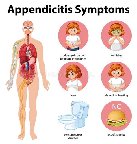 Appendicitis Symptoms Information Infographic Stock Vector