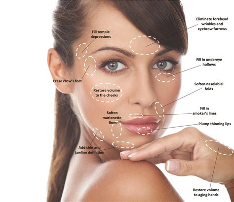 Beginner S Guide To Dermal Fillers What To Expect Medwell Aesthetics