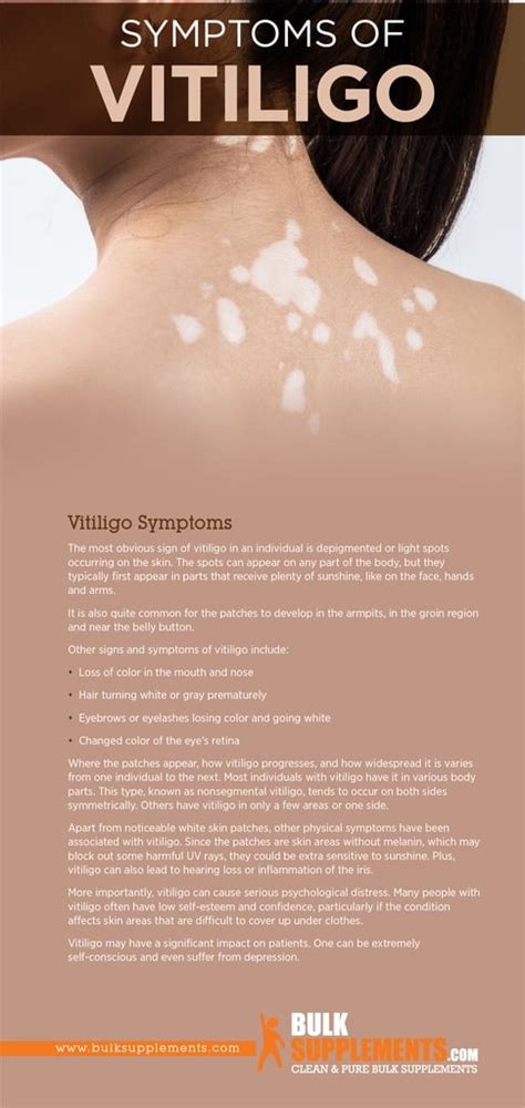 Vitiligo Symptoms Causes And Treatment