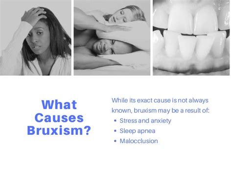 Bruxism Causes Risks Treatment And Prevention