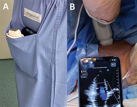 Portable Point Of Care Ultrasound Ppocus An Emerging Technology For