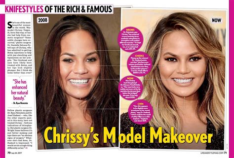 Image result for CHRISSY TEIGEN BEFORE AND AFTER PLASTIC SURGERY | Chrissy teigen, Chrissy ...