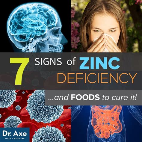 Zinc Deficiency Symptoms And The Best Foods To Reverse It Zinc Deficiency Health Health