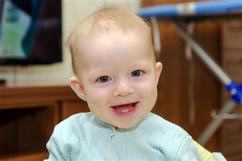 Baby Born With Teeth Is This Normal Parenting Hours