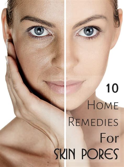 20 Home Remedies To Get Rid Of Open Pores On Skin Permanently • Veryhom