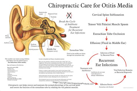Chiropractic Treatment Of Ear Infections Poster