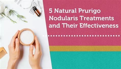 5 Natural Prurigo Nodularis Treatments And Their Effectiveness