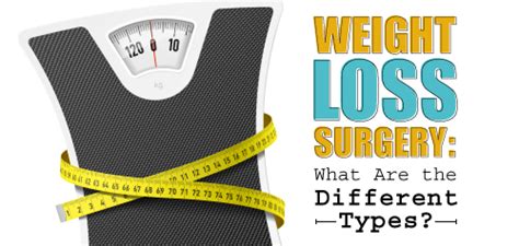 Types Of Weight Loss Surgery Dr Steven Fass