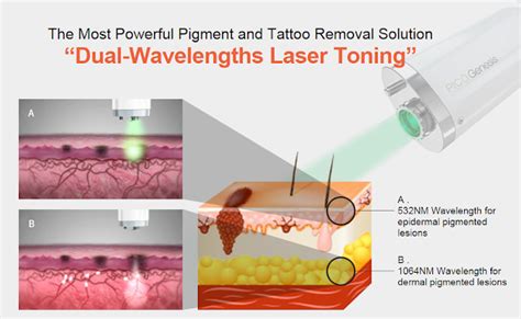 Renewme Skin Clinic Most Advanced Pico And Nano Enlighten Laser For