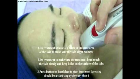 Fractional Rf Thermage Face Lifting Skin Tightening 1 Youtube