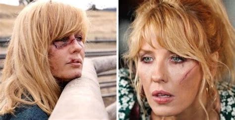 Yellowstone Hidden Meaning In Beth Duttons Scars Exposed It Tells A