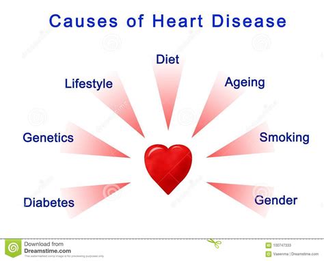 Causes of Heart Disease stock illustration. Illustration of causes ...