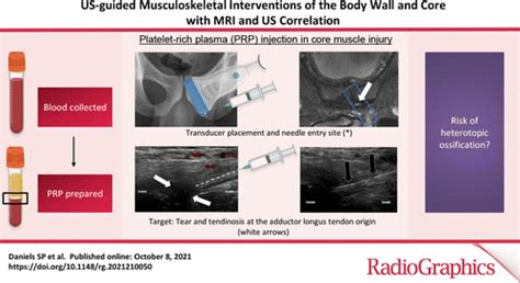 Us Guided Musculoskeletal Interventions Of The Body Wall And Core With