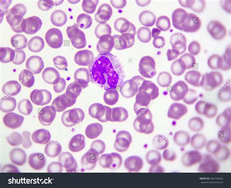Monocyte Cell White Blood Cell In Peripheral Blood Smear Wright