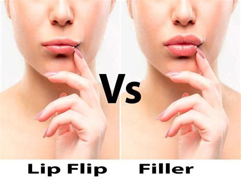 Botox Lip Flip How Many Units Healthy Anozo