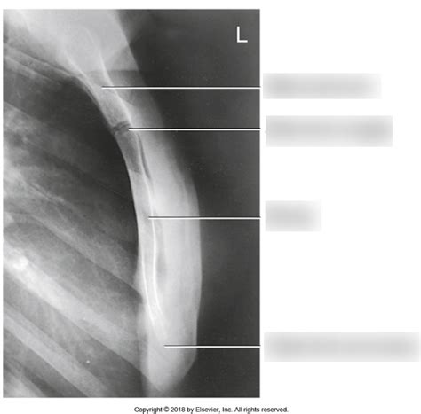 Diagram Lateral Sternum Anatomy Xray Diagram Quizlet