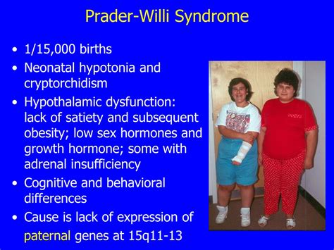 PPT Update On Medical Issues In Prader Willi Syndrome PowerPoint