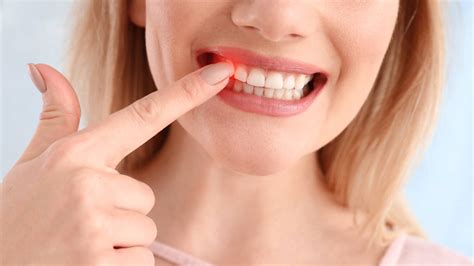 Paradontoza Przyczyny Objawy Leczenie Profilaktyka Happy Dental