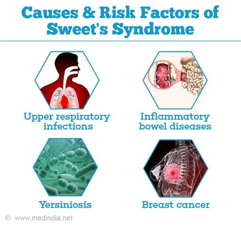 sweet s syndrome causes clinical features diagnosis and management