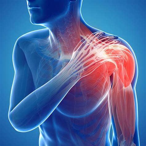 Shoulder And Upper Arm Gmphysio
