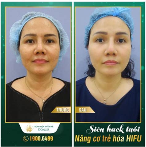 Tuy nhiên, tùy theo độ tuổi lại có những mức chỉ số huyết áp an toàn riêng mà không phải ai cũng có nghĩa là, khi dùng máy đo huyết áp để đo, nếu người nào có tỷ lệ tăng huyết áp cao hơn hoặc thấp hơn nên cẩn thận trong chế độ ăn. BẠN BAO NHIÊU TUỔI KHÔNG QUAN TRỌNG. QUAN TRỌNG LÀ BẠN TRÔNG NHƯ BAO NHIÊU