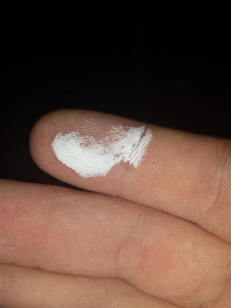 Just Noticed This White Stuff On My Finger And It Will Not Come Off