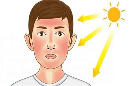 پیشگیری از آفتاب سوختگی با چند ماده غذایی بهار نیوز