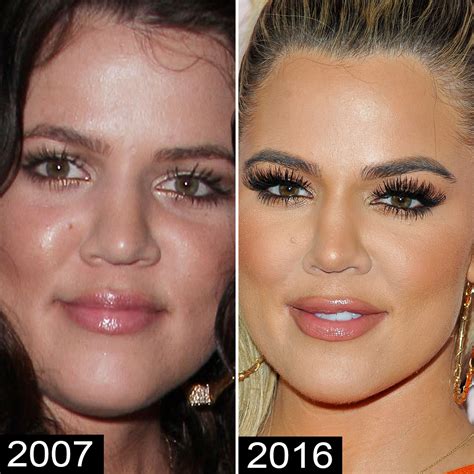 Kardashians Before And After Photos