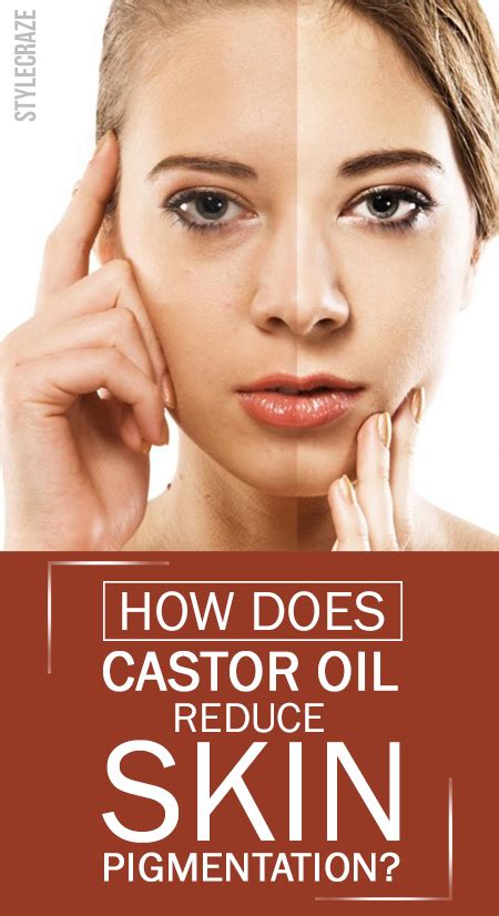 It carries high amounts of moisture, fatty acids. How Does Castor Oil Reduce Skin Pigmentation?