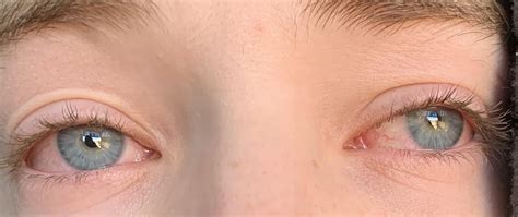 My Stoned Friends Eyes R Pics