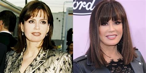 Did Marie Osmond Have Plastic Surgery Her Face Before And After Laptrinhx News