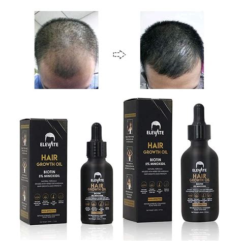 Elevate Hair Growth Oil Biotin Hair Growth Serum And 5 Minoxidil